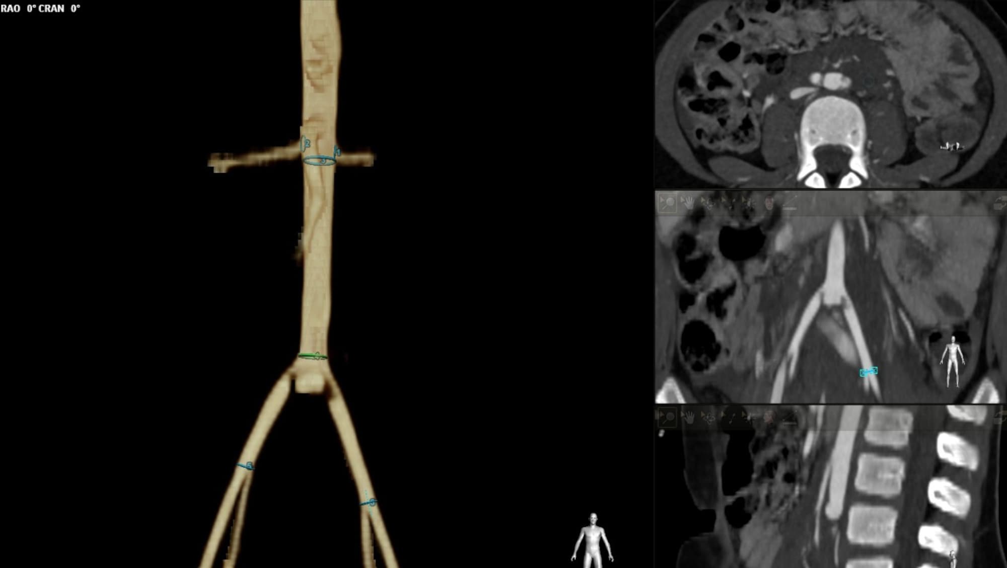 Girl, 6, Nearly Killed When Holy Water Font Falls On Her In Church And Rips Her Aorta