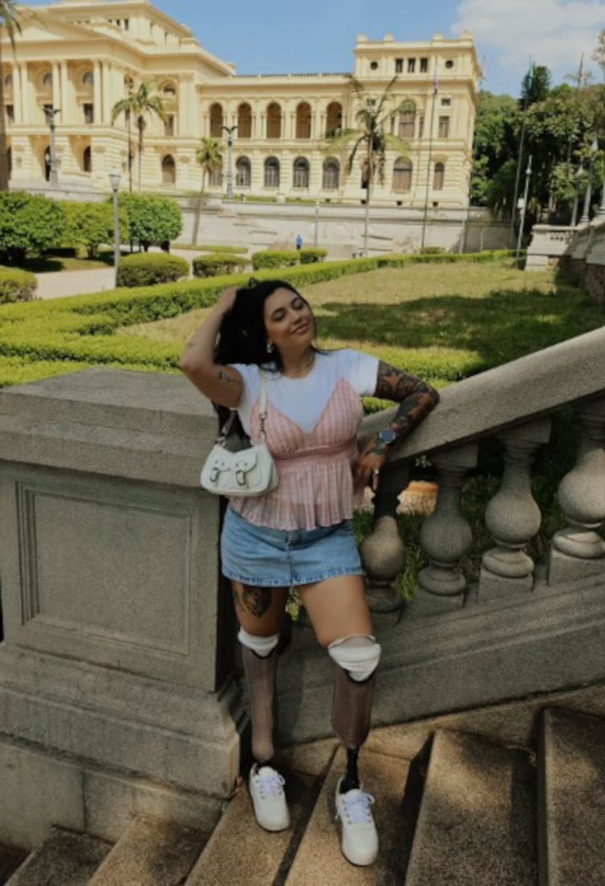 Influencer Abandoned By Boyfriend After Double Amputation And Then Finds Love Again