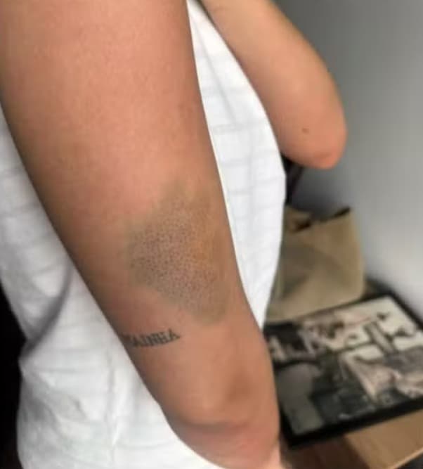 Picture shows the injuries on Jessica Soares' body, undated. She confronted a stranger who attempted to rape her in her apartment in Baueri, Brazil. Note: Private photo. (Newsflash/NX)