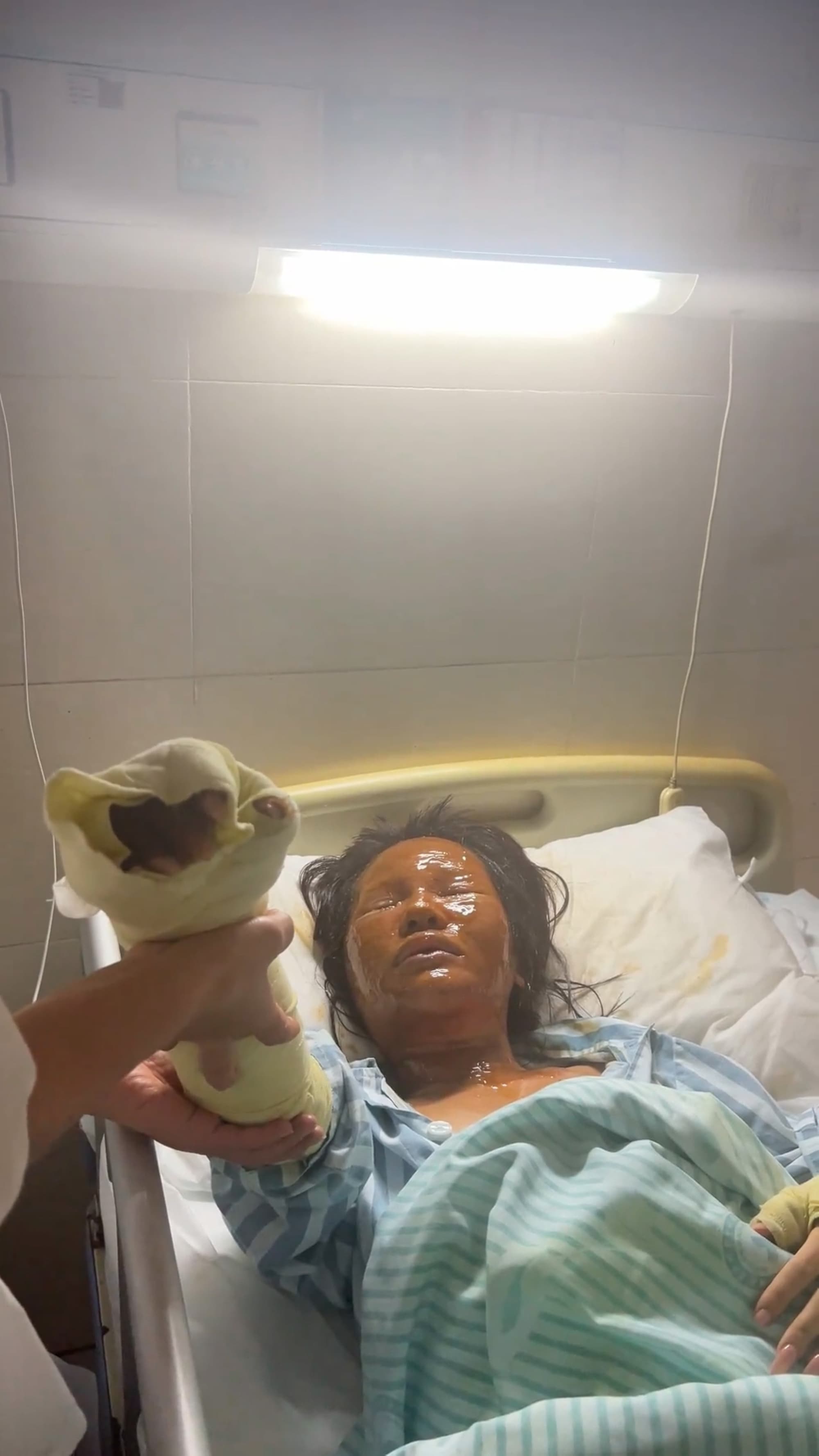Video shows the injured livestreamer Sisi in undated footage. When she went out to pick up a package from the shoe rack, the package exploded. Sisi was hit by the blast and suffered burns of varying degrees to her face, neck, and both arms on Oct. 15, 2025. Note: Photo is a screenshot from a video. (AsiaWire/NX)