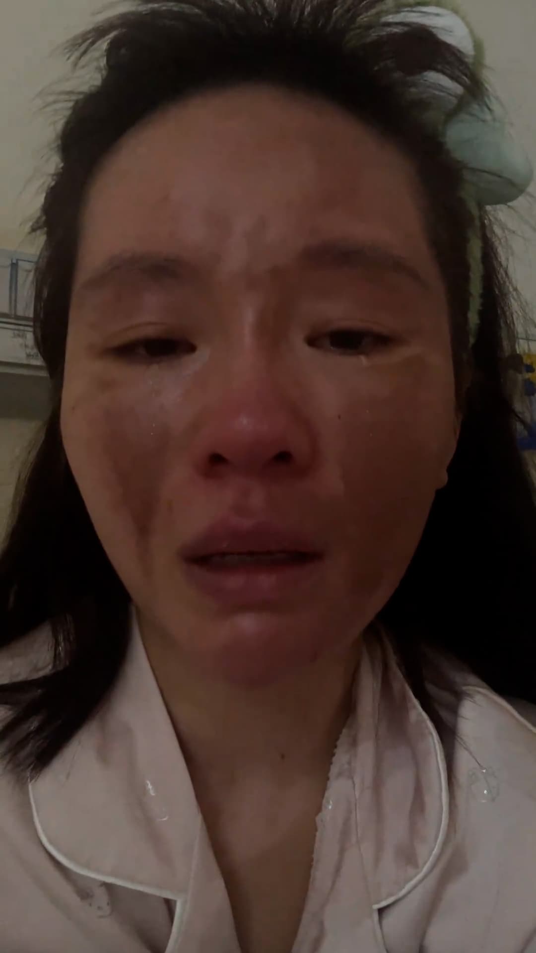 Video shows the injured livestreamer Sisi in undated footage. When she went out to pick up a package from the shoe rack, the package exploded. Sisi was hit by the blast and suffered burns of varying degrees to her face, neck, and both arms on Oct. 15, 2025. Note: Photo is a screenshot from a video. (AsiaWire/NX)